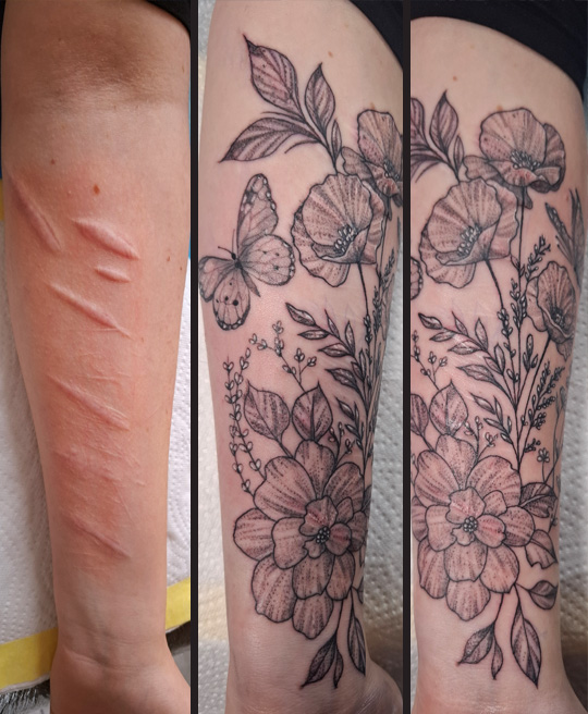 Narben tattoos